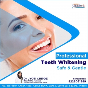 Smile makeover treatment available in Indore | Dental Implan