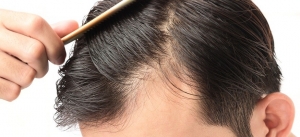 Hair Loss Treatment In Chandigarh