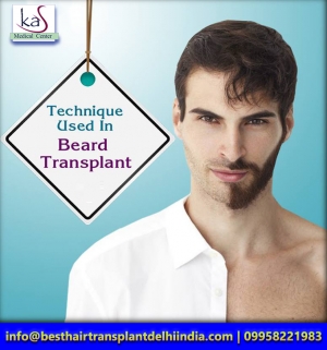Beard Transplant Surgery South Delhi