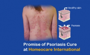 Solve Your Skin Disease Problem With Homeopathy