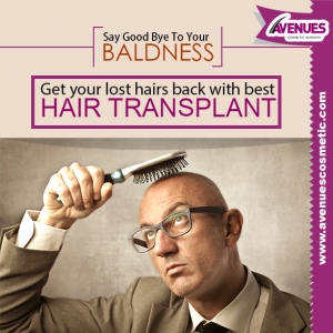 Not Looking Attractive Due To Baldness?Get Treatment by Dr.K