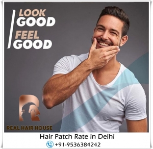 Hair Patch in Delhi 