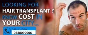  Hair Transplant Cost in Delhi 