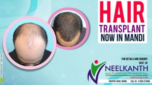 Hair Transplant in Himachal 