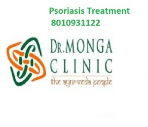 Psoriasis treatment in Azadpur
