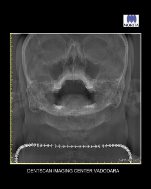 DentScan Imaging Centre- Digital Dental x ray| CBCT services