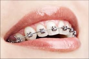 Best dentist in Indore | Tooth pain treatment in Indore