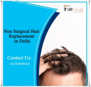 Hair Patch in Gurgaon