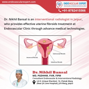 Interventional radiologist in Jaipur treats Uterine Fibroid
