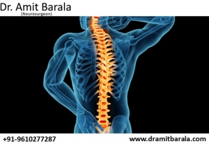 Best Stroke Doctor in Jaipur