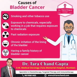 Causes of the Bladder Cancer