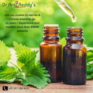 best homeopathy treatment in Hyderabad