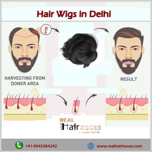 Hair Wigs in Delhi