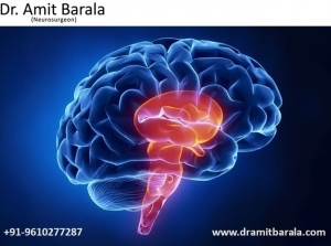 Best Neurology Doctor in Jaipur