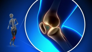 Knee replacement surgeon in M.P | Knee specialist in Indore